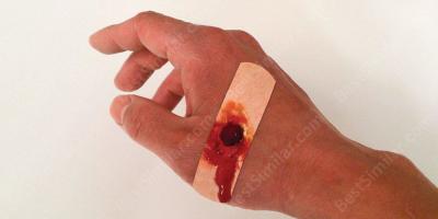 wound movies