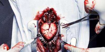 heart surgery movies